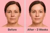 Flordeseo SkinLift Pro – Advanced Microcurrent Facial Device